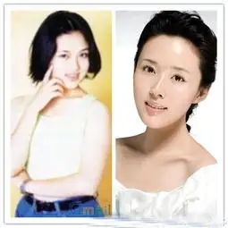 大饼变锥子当红女星削骨前后震撼大对比