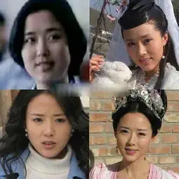 angelababy袁珊珊李小璐女星整容陷雷人凹凸脸